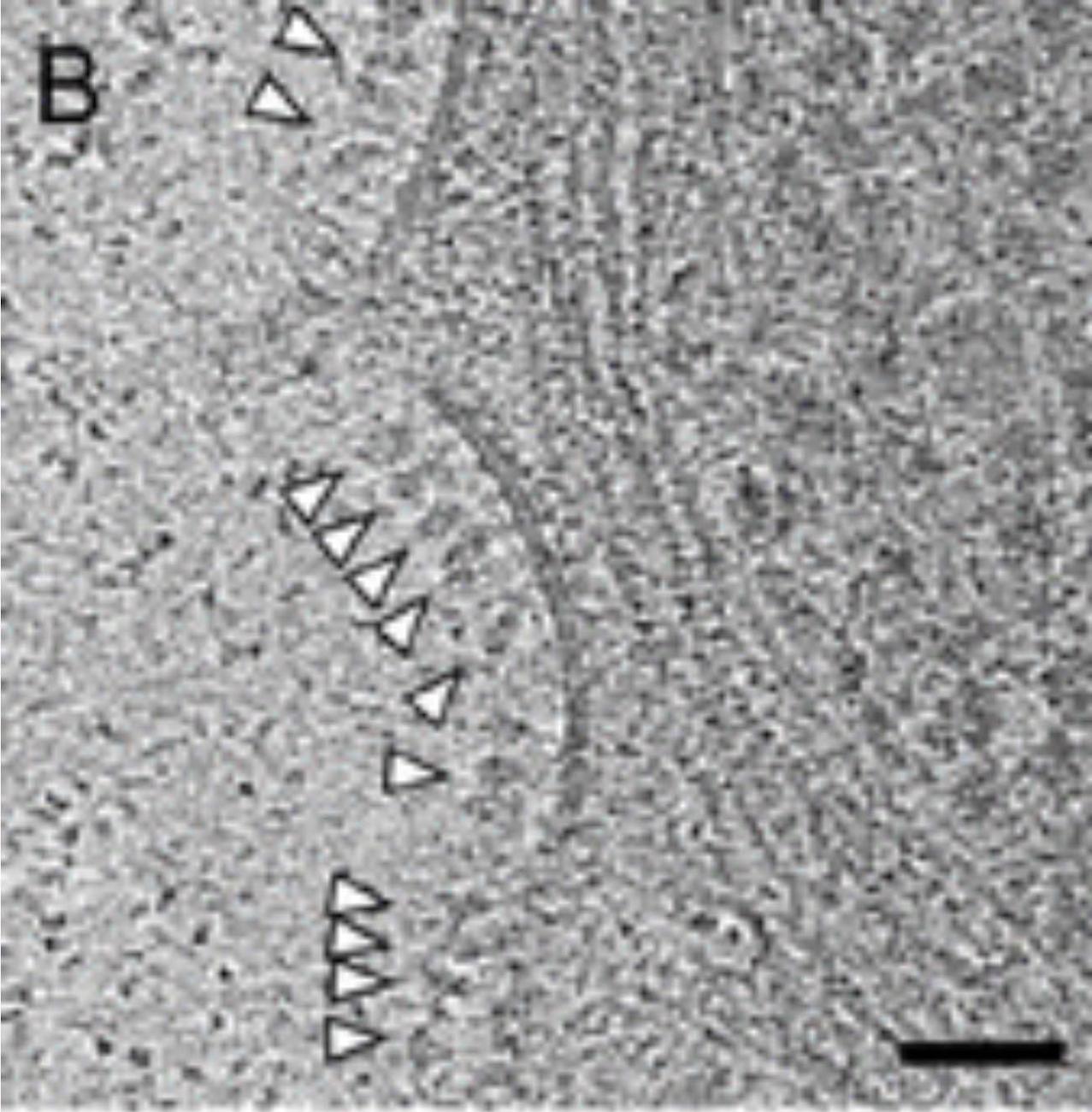 Spike proteins on the surface of cells as a result of Astrazeneca vaccine