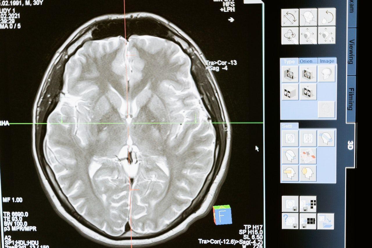 Brain scan