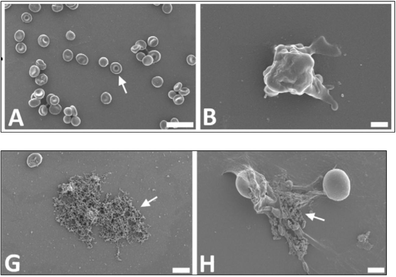 whole blood with and without spike protein