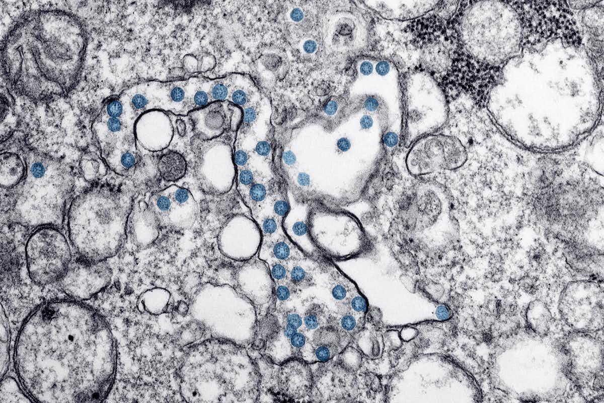 Transmission electron microscopic image of an isolate from the first U.S. case of COVID-19, formerly known as 2019-nCoV. 